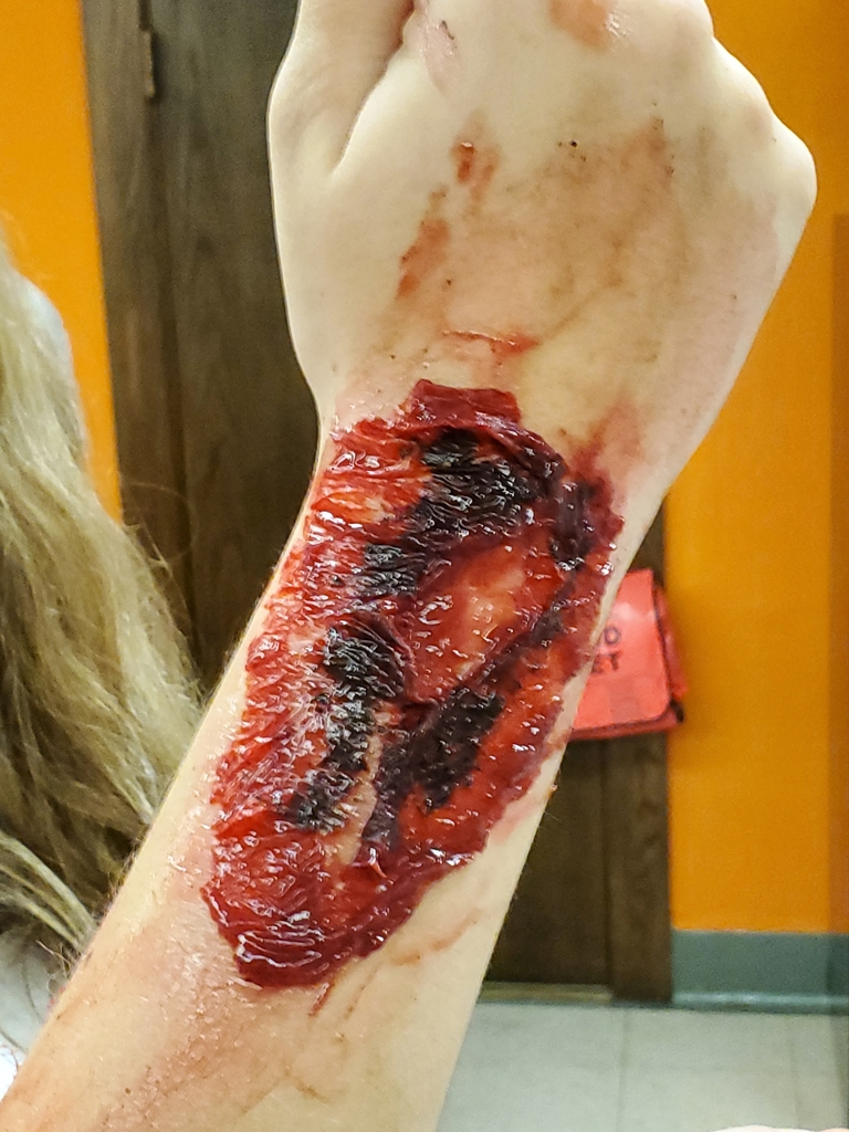 pretty good zombie bite!